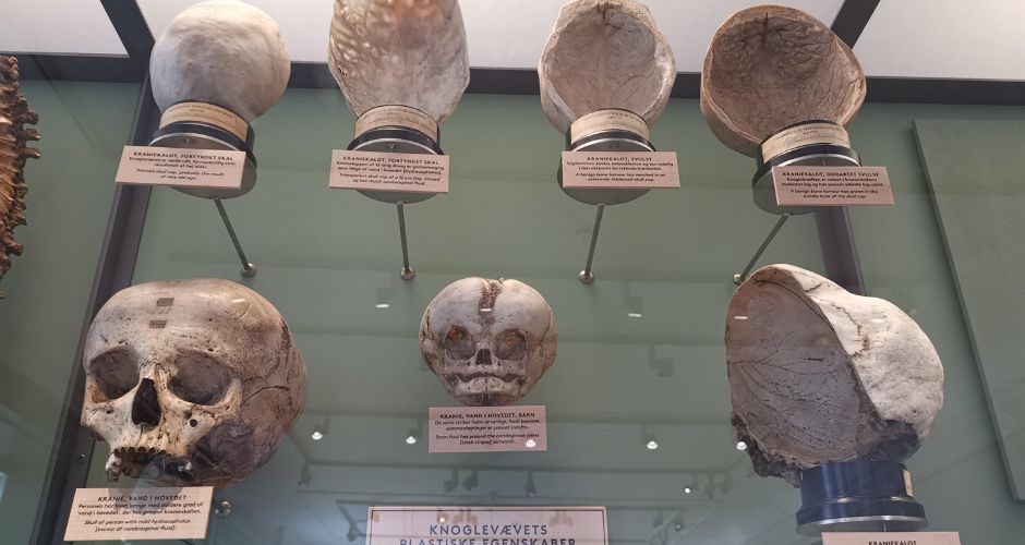 Medical Museion_Copenhagen_Skull Collection.jpg